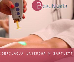 Depilacja laserowa w Bartlett