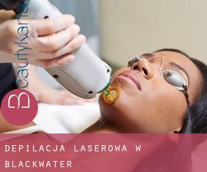 Depilacja laserowa w Blackwater