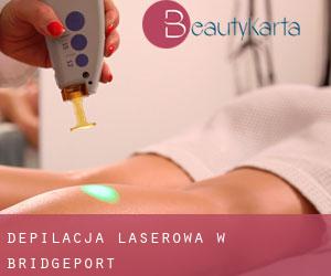 Depilacja laserowa w Bridgeport