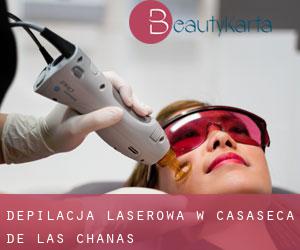 Depilacja laserowa w Casaseca de las Chanas