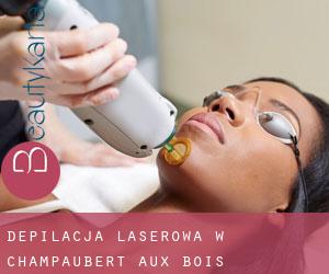 Depilacja laserowa w Champaubert-aux-Bois