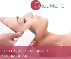 Depilacja laserowa w Chelborough