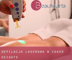 Depilacja laserowa w Coker Heights