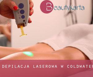 Depilacja laserowa w Coldwater