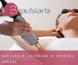 Depilacja laserowa w Crystal Spring