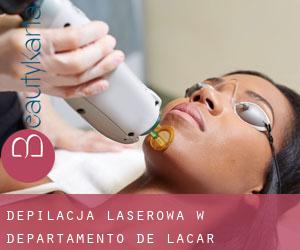 Depilacja laserowa w Departamento de Lácar