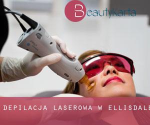 Depilacja laserowa w Ellisdale