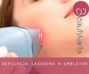 Depilacja laserowa w Embleton