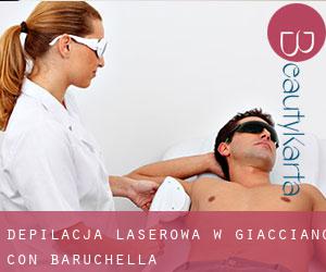 Depilacja laserowa w Giacciano con Baruchella