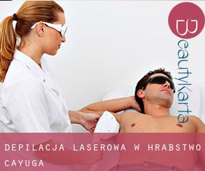Depilacja laserowa w Hrabstwo Cayuga Depilacja laserowa w Hrabstwo Cayuga