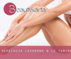 Depilacja laserowa w Le Tertre Depilacja laserowa w Le Tertre