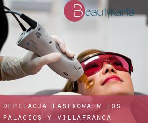 Depilacja laserowa w Los Palacios y Villafranca