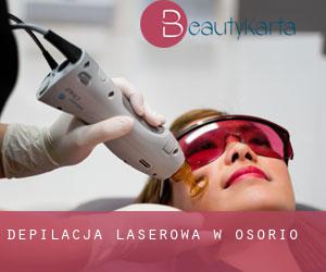 Depilacja laserowa w Osório