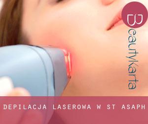 Depilacja laserowa w St Asaph