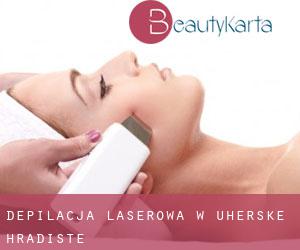 Depilacja laserowa w Uherské Hradište Depilacja laserowa w Uherské Hradište