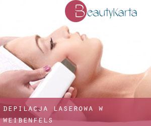 Depilacja laserowa w Weißenfels Depilacja laserowa w Weißenfels