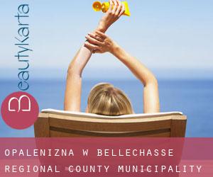 Opalenizna w Bellechasse Regional County Municipality