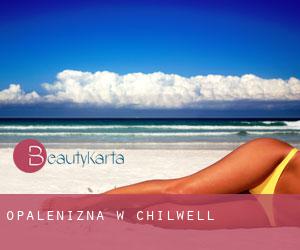 Opalenizna w Chilwell Opalenizna w Chilwell