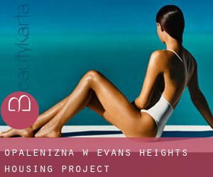 Opalenizna w Evans Heights Housing Project