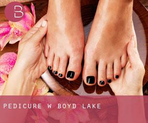 Pedicure w Boyd Lake