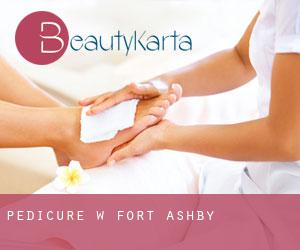 Pedicure w Fort Ashby