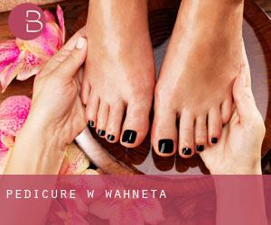 Pedicure w Wahneta