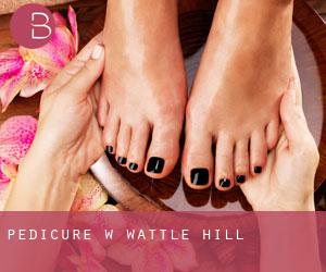 Pedicure w Wattle Hill Pedicure w Wattle Hill